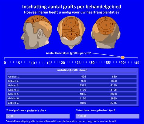 Haartransplantatie Kosten In Vergelijking Met Andere Haaroplossingen