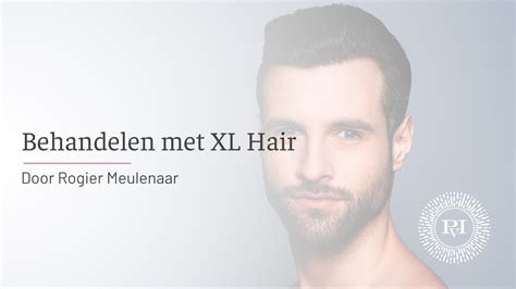 Hoe Werkt XL Hair In Vergelijking Met Andere Methoden?