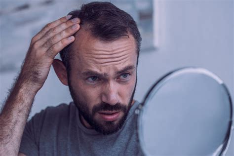 De Belangrijkste Misvattingen Over Haartransplantatie