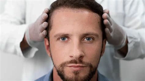 Het Effect Van Leeftijd Op Haartransplantatie